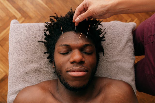Facial Acupuncture